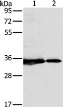 Anti-NDUFA3 antibody