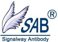 Recombinant Human Aspartoacylase(ASPA)