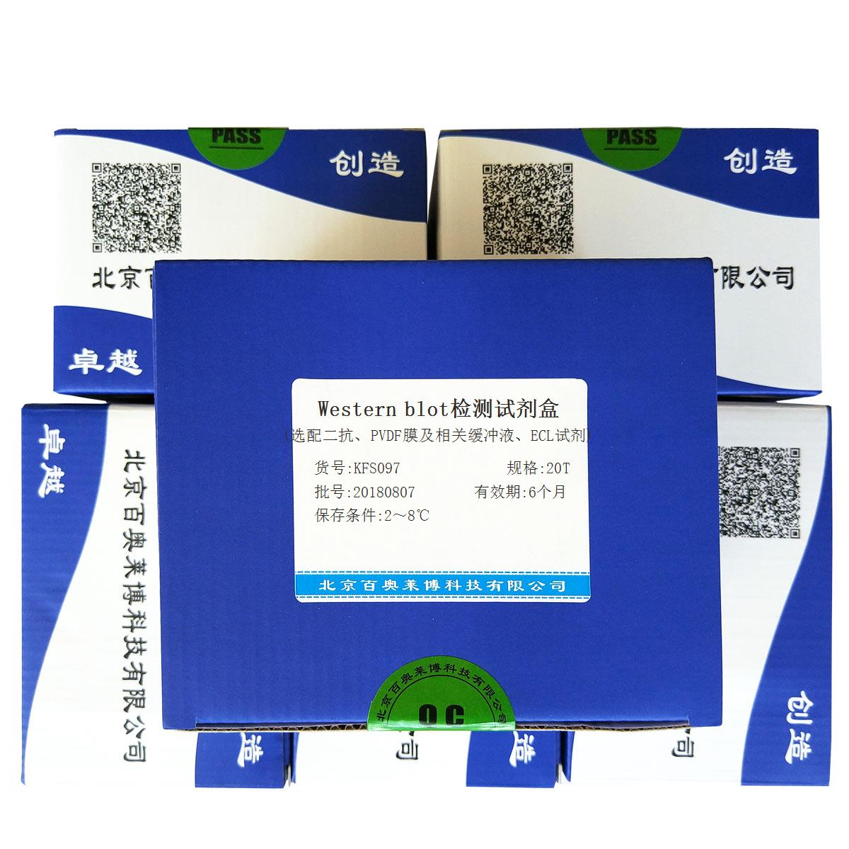 Western blot检测试剂盒(选配二抗、PVDF膜及相关缓冲液、ECL试剂)