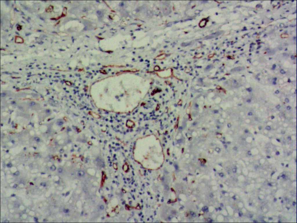 中杉金桥ZM-0044CD31 小鼠抗人内皮细胞（CD31）单克隆抗体 Mouse anti-CD31 Monoclonal Antibody  （Endothelial Cell）