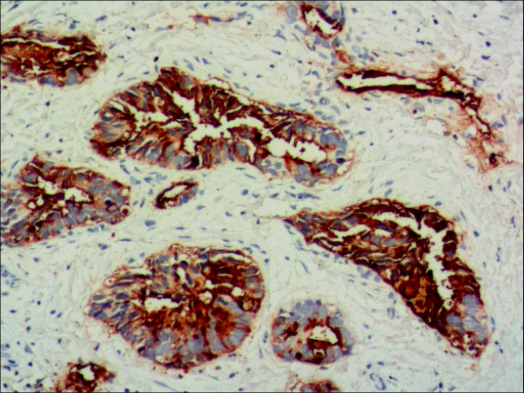 中杉金桥ZM-0021CA19-9 小鼠抗人结肠癌相关抗原（CA19-9）单克隆抗体 Mouse anti-CA19-9 Antigen Monoclonal Antibody