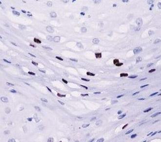 中杉金桥ZM-0217HPV-16 小鼠抗人乳头状*病*16型单克隆抗体 Mouse anti-HPV-16 Monoclonal Antibody