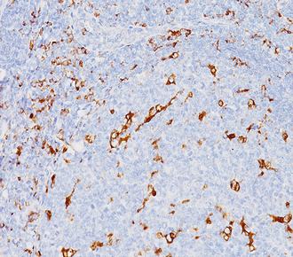 中杉金桥ZM-0060CD68 小鼠抗人巨噬细胞单克隆抗体 Mouse anti-CD68 (Human Macrophage) Monoclonal Antibody