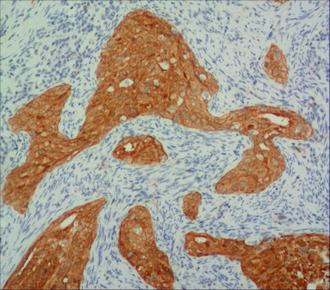 中杉金桥ZM-0205p16 小鼠抗人p16INK4a蛋白单克隆抗体 Mouse anti-p16INK4a Monoclonal Antibody产品图