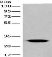 Anti-CACNG3 antibody