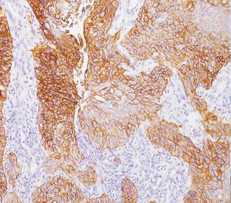 中杉金桥ZM-0093EGFR 小鼠抗人表皮生长因子受体单克隆抗体 Mouse Anti-EGFR Monoclonal Antibody (Epidermal Growth Factor Receptor)