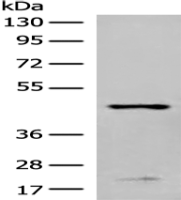 Anti-CHST11 antibody