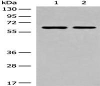 Anti-CREB3L2 antibody