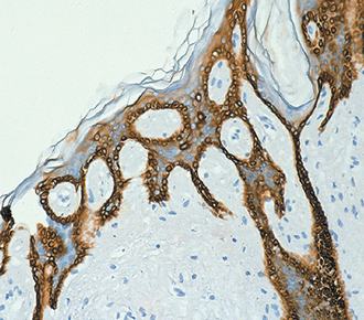 中杉金桥ZM-0067CK(AE1) 小鼠抗人细胞角蛋白(AE1)单克隆抗体 Mouse anti-Cytokeratin(AE1)Monoclonal Antibody产品图