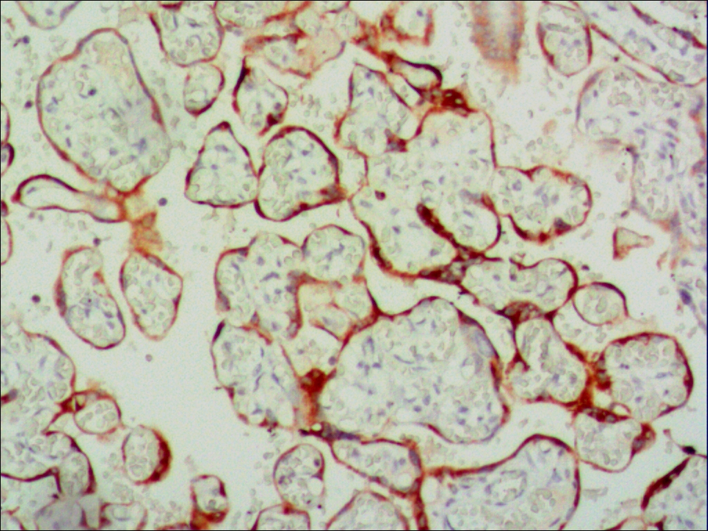 中杉金桥ZM-0134β-HCG 小鼠抗人绒毛膜促性腺激素β链单克隆抗体 Mouse anti-HCG β Monocolnal Antibody （Beta-Human Chorionic Gonadotropin）