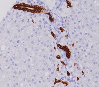 中杉金桥ZM-0074CK19 小鼠抗人细胞角蛋白19单克隆抗体 Mouse anti-CK 19 Monoclonal Antibody