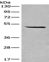 Anti-SPOCK3 antibody