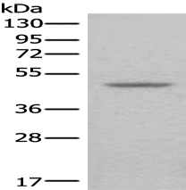 Anti-MAGEA11 antibody