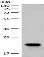 Anti-RAC3 antibody