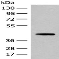 Anti-SMS antibody
