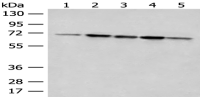 Anti-ACSF2 antibody