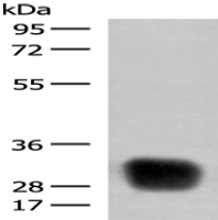 Anti-HLA-DRB4 antibody