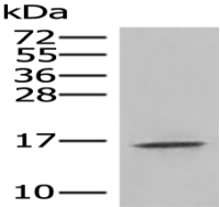 Anti-IL36RN antibody