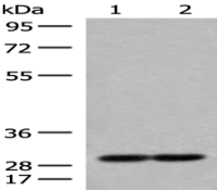 Anti-MRPS18B antibody