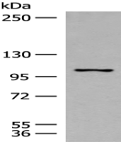 Anti-RNF111 antibody