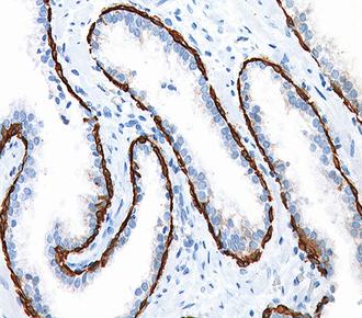 中杉金桥ZM-0308CK(34βE12) 小鼠抗人细胞角蛋白（高分子量）单克隆抗体 Mouse anti-Cytokeratin (34βE12) Monoclonal Antibody