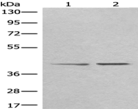 Anti-TMEM248 antibody