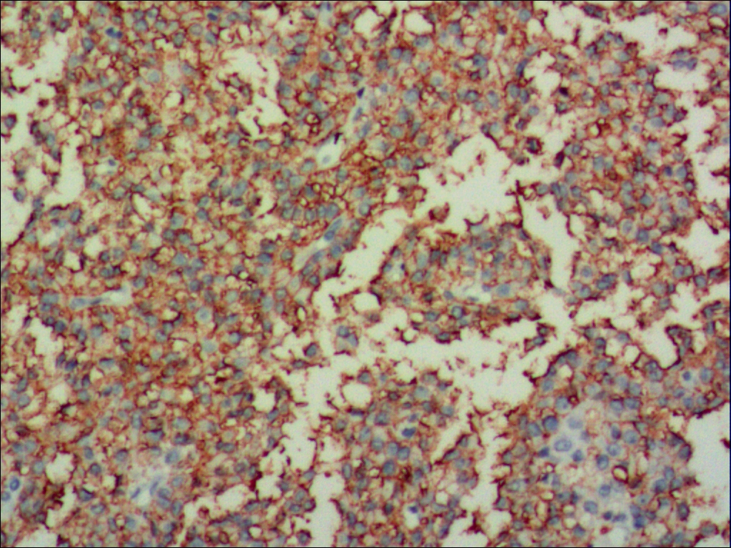 中杉金桥ZM-0296CD99 小鼠抗人CD99单克隆抗体 Mouse anti-CD99 Monoclonal Antibody