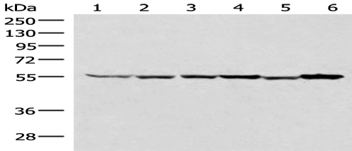 Anti-RUVBL1 antibody