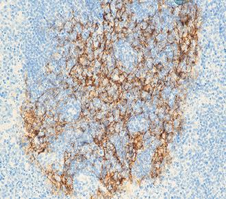 中杉金桥ZM-0273CD23 小鼠抗人CD23单克隆抗体 Mouse anti-Human CD23 Monoclonal Antibody