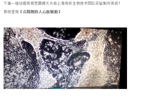 【会跳舞的人心肌细胞】——你见过吗？