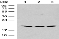 Anti-RPL23A antibody