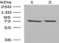 Anti-POMGNT1 antibody