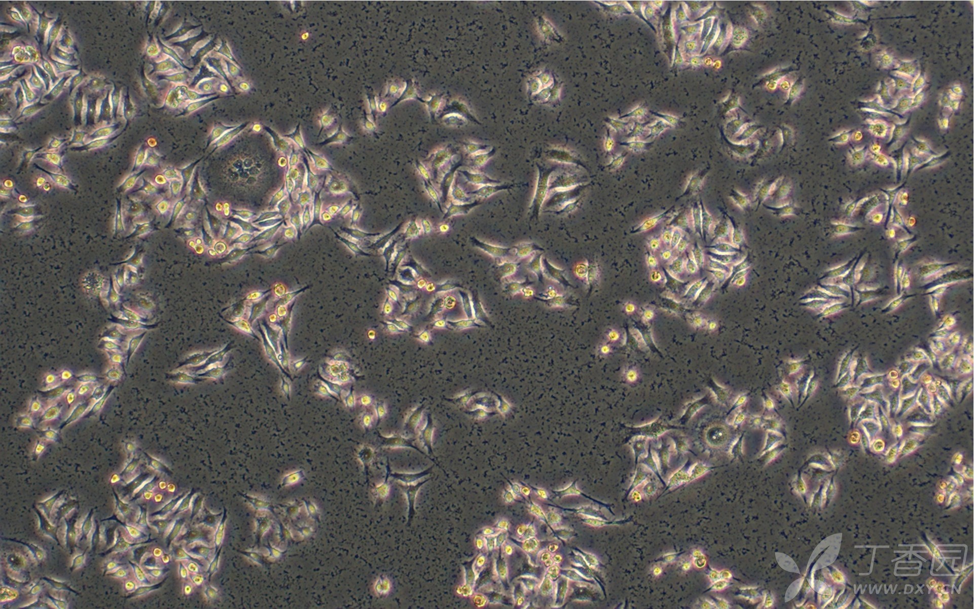 肝癌细胞经过某种药物处理后出现背景变得很脏,请问大家知道大概什么