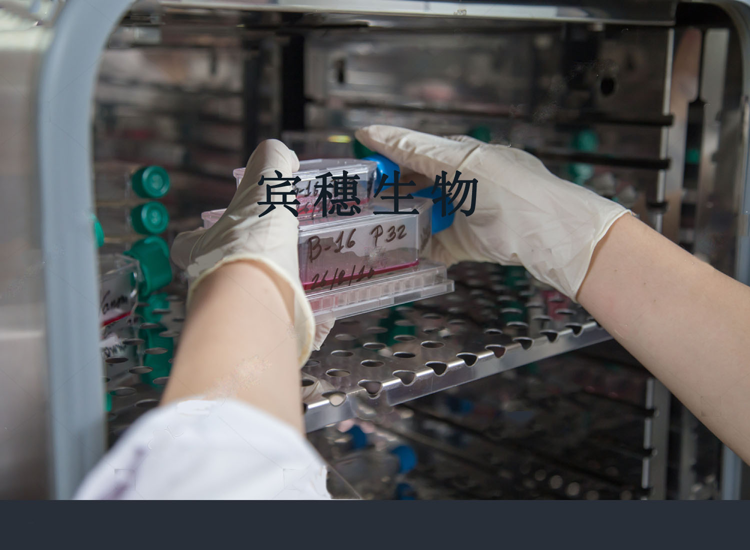 SNU-475细胞；人肝癌细胞