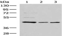 Anti-ACTL6B antibody