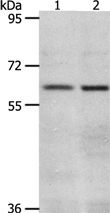 Anti-VNN2 antibody