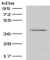 Anti-MECR antibody