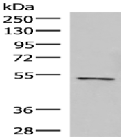 Anti-POLD2 antibody