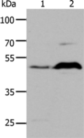 Anti-HTR1A antibody