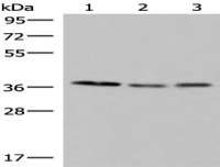 Anti-POLR3F antibody