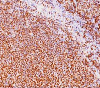 中杉金桥ZA-0101Cyclin D1 兔抗人周期素D1单克隆抗体 Rabbit anti-Cyclin D1 Monoclonal Antibody