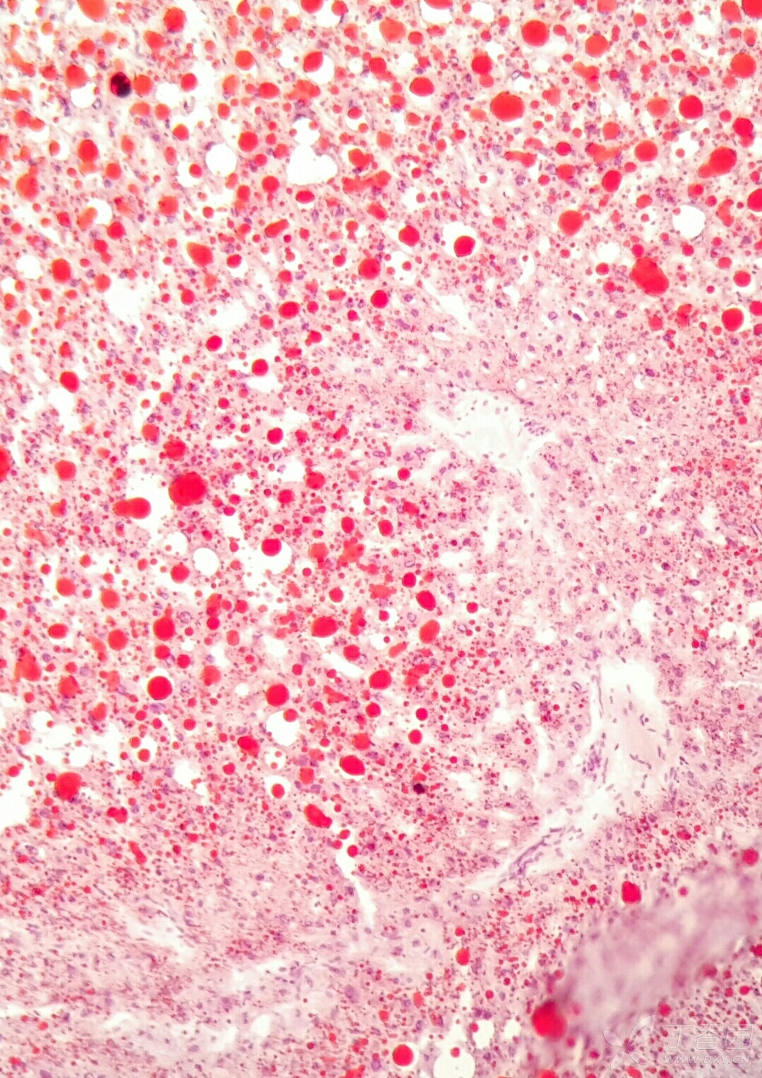 MPO染色图片