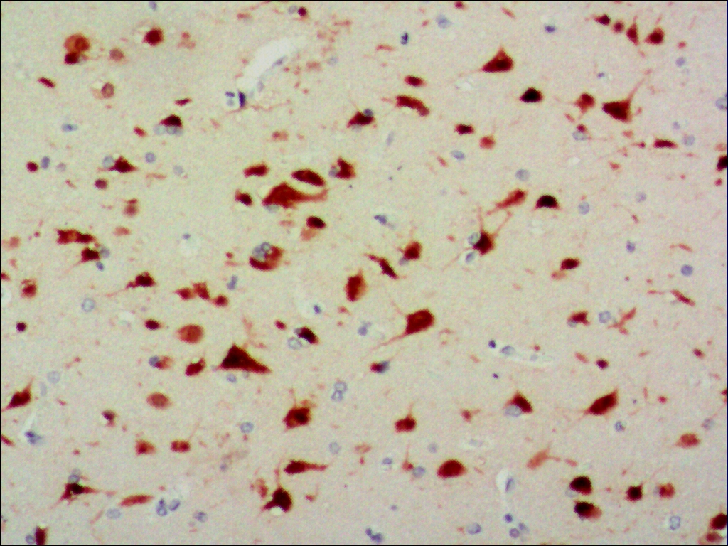 中杉金桥ZM-0352NeuN 小鼠抗人NeuN单克隆抗体 Mouse anti-Neu N Monoclonal Antibody