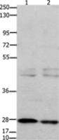 Anti-GNRHR antibody