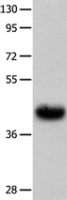 Anti-UTS2R antibody