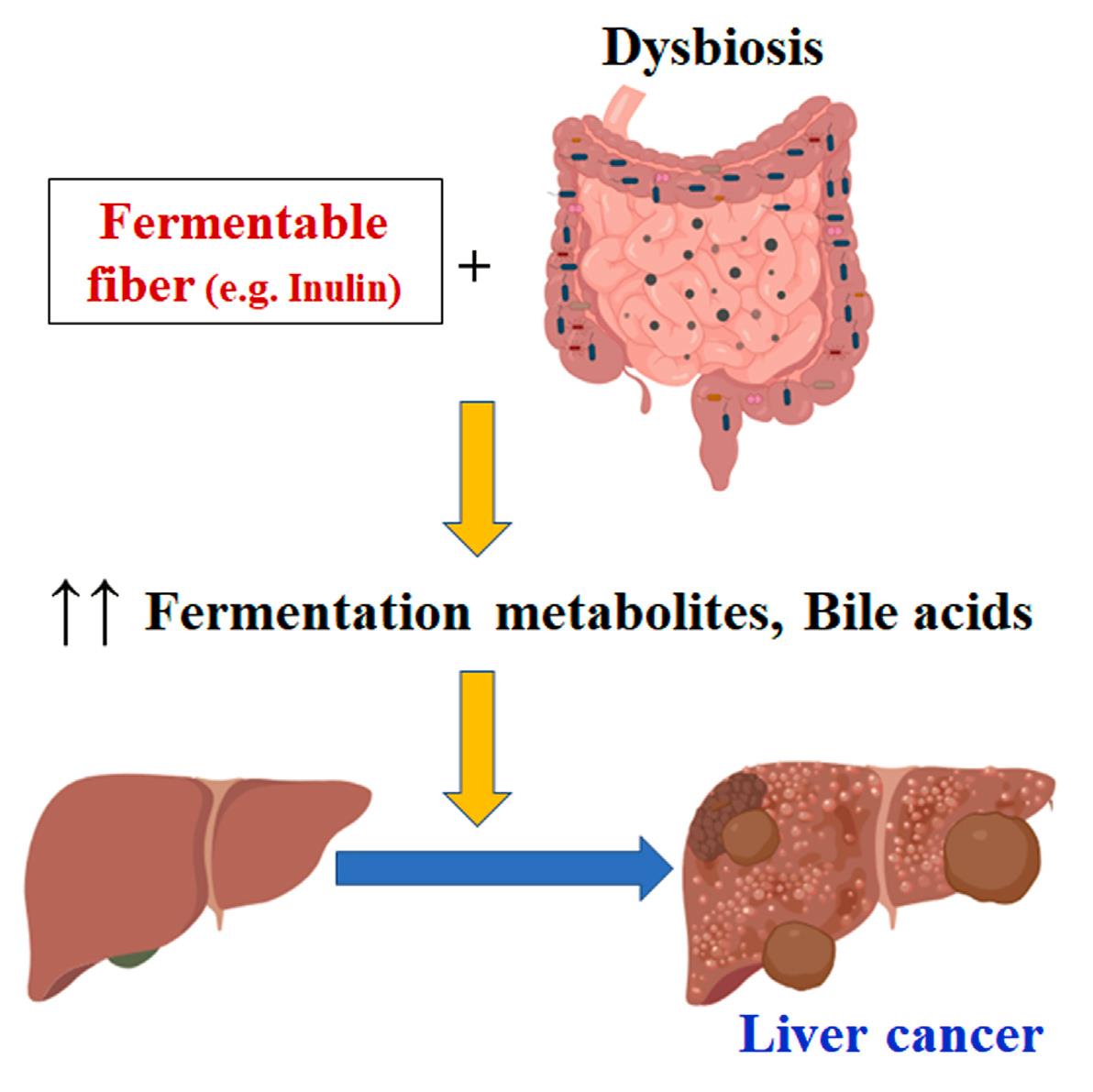 Cell | 可溶性纤维的微生物发酵失调诱导胆汁淤积性肝癌