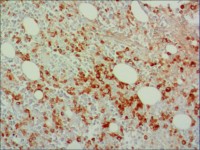 中杉金桥ZA-0197Myeloperoxidase 兔抗人髓过氧化物酶多克隆抗体 Rabbit anti-Myeloperoxidase Polyclonal Antibody