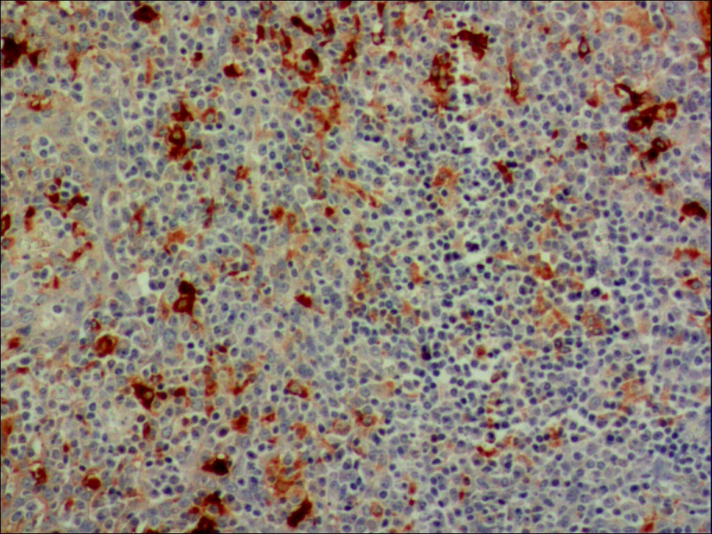 中杉金桥ZA-0006AACT 兔抗人α-1-抗胰糜蛋白酶多克隆抗体 Rabbit anti-AACT Polyclonal Antibody（Alpha-1-Antichymotrypsin）