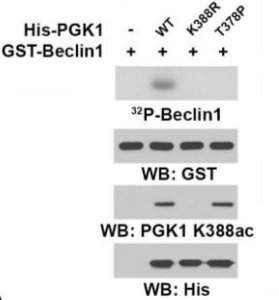 PGK1 (Acetyl-Lys388) Antibody
