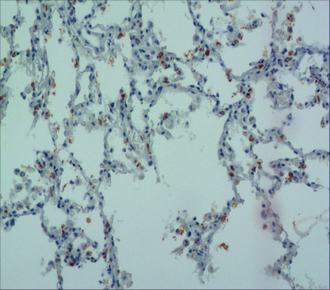 中杉金桥ZM-0478SPA 小鼠抗人肺表面活性蛋白A单克隆抗体 Mouse anti-Surfactant Protein A Monoclonal Antibody